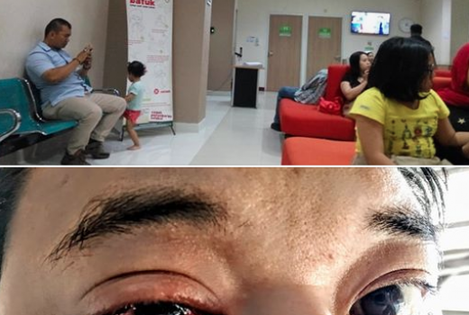 Mata Pemuda Ini Iritasi Sebab Abu Rokok yang Dibuang oleh Pemotor - GenPI.co