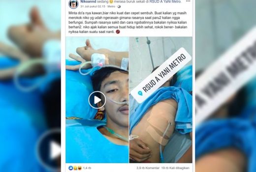Kebanyakan Ngudud, Paru-paru Pemuda ini Kolaps dan Terpaksa Dibor - GenPI.co