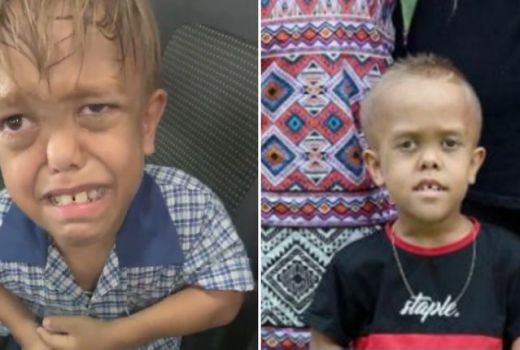 Dirundung Terus Karena Kerdil, Anak ini Ingin Bunuh Diri - GenPI.co