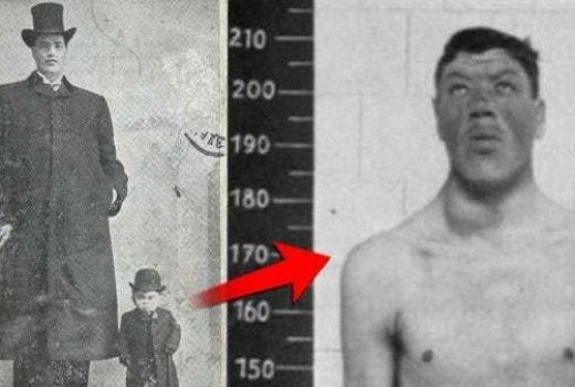 Aneh! Manusia Kerdil ini Tumbuh Jadi Raksasa dalam 10 Tahun - GenPI.co