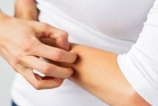 Ladies, Nih Merawat Kulit Kering Akibat Alergi Polusi - GenPI.co