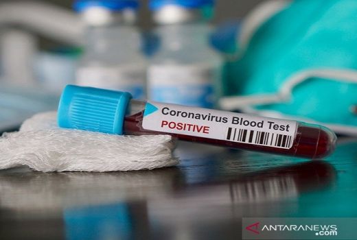 Jakarta Selatan Wilayah Pertama Menjalani Rapid Test Corona - GenPI.co
