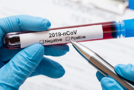 Duh, CDC Tetapkan 6 Gejala Baru Covid-19 - GenPI.co