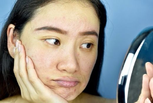 Selain Untuk Diet, Oatmeal Bisa Mengatasi Wajah Iritasi Loh! - GenPI.co