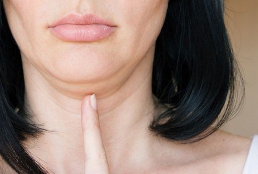 3 Cara Menghilangkan Double Chin, Berani Mencoba? - GenPI.co