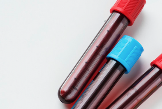 Pakar Rinci Cara Menangani Penderita Hemofilia - GenPI.co