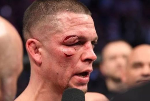 Pemulihan Mata Kanan, Petarung Nate Diaz Harus Istirahat 90 Hari - GenPI.co