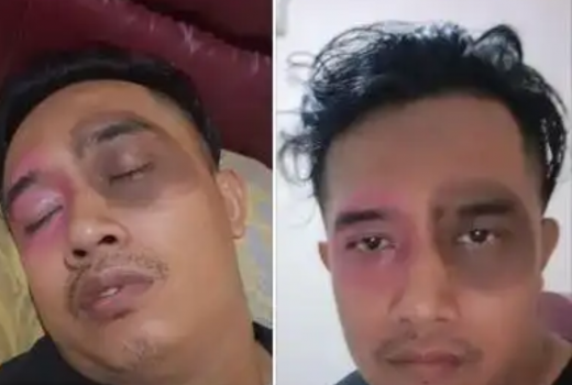 Sumpah Kocak Banget, Gegara Jarang Jamah Istri, Suami Jadi Begini - GenPI.co