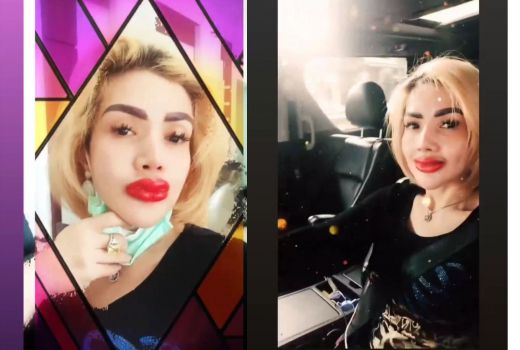 Sulam Bibir, Barbie Kumalasari Merah Merona dan Membengkak - GenPI.co