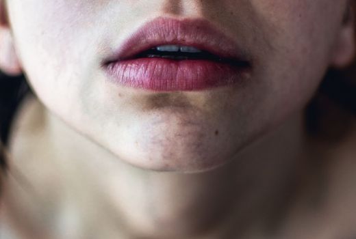Waduh! 4 Kebiasaan Ini Perparah Bibir Kering - GenPI.co
