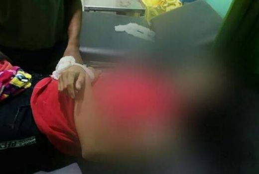 Nih Kronologis Biduan Dangdut Tewas Dikeroyok dan Dilempari Batu - GenPI.co