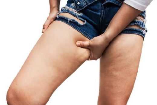 Ingin Hilangkan Lemak di Paha Secara Alami, Lakukan 5 Cara Ini... - GenPI.co