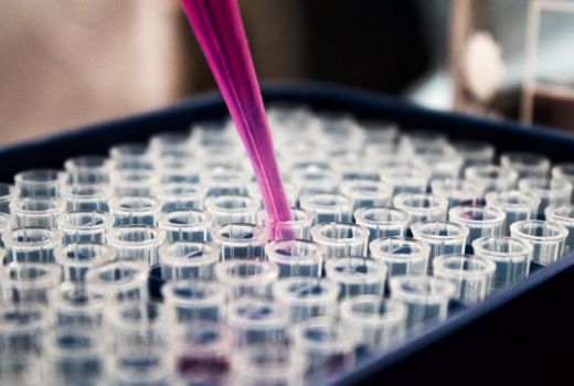 Digigit Ular Cobra, Serum Abu Kini jadi Obat Anti Bisa - GenPI.co
