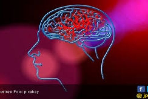 Stroke Ringan? Terapi Stem Cell Sangat Disarankan - GenPI.co