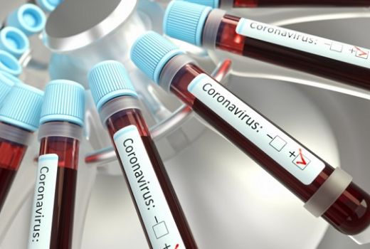 Israel Top Banget, Bisa Melacak Keberadaan Virus Corona - GenPI.co