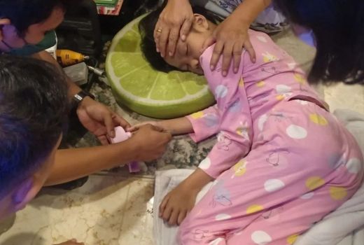 Jari Seorang Bocah di Depok Tersangkut di Tutup Kaleng - GenPI.co JABAR