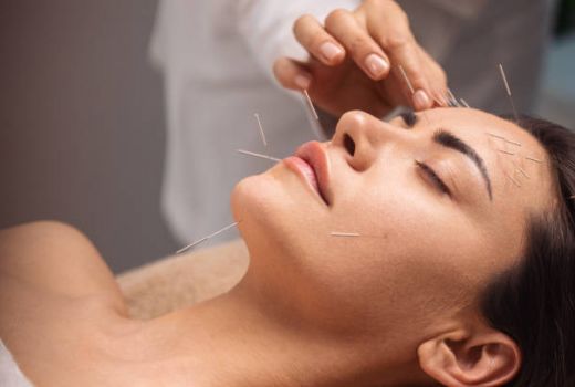 Wow! Akupunktur Ternyata Bisa Bikin Wajah Glowing - GenPI.co JATENG