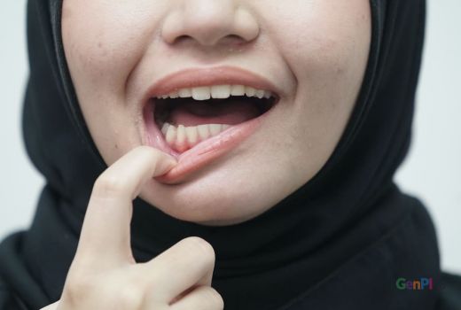 Ini Tips Agar Mulut Tidak Bau saat Puasa Ramadan - GenPI.co JATENG