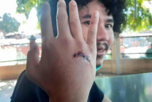 Hendak Cari Sahur, Editor Detikcom Surabaya Dikeroyok - GenPI.co JATIM
