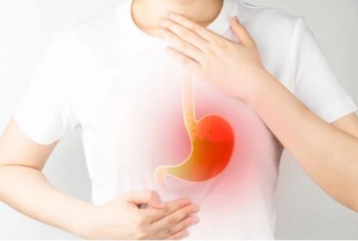 Mengenal Sakit GERD yang Kasusnya Meningkat saat Pandemi - GenPI.co KALTIM