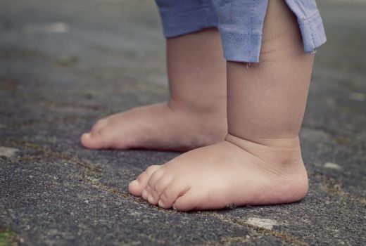 Dokter Beberkan Tanda-tanda Anak Alami Stunting - GenPI.co KALTIM