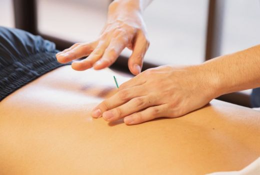 Manfaat Akupunktur, Bisa Sembuhkan Migrain - GenPI.co KALTIM