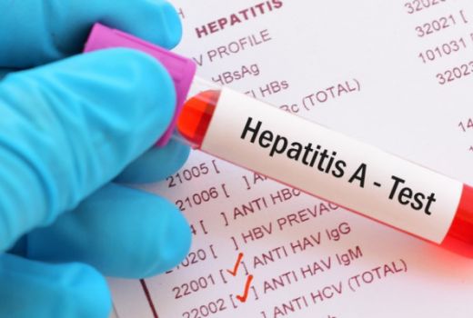 Jadi KLB di Pacitan, Begini Tanda Terkena Penyakit Hepatitis A - GenPI.co