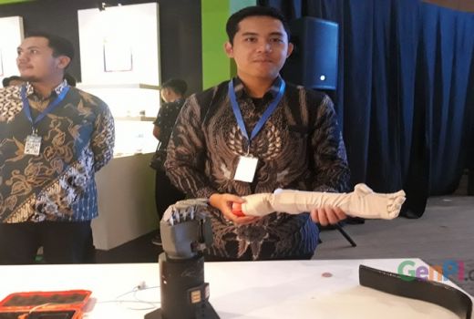 Teknologi Tangan Bionik Karya Anak Bangsa - GenPI.co
