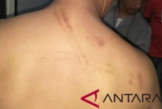 Punggung Mahasiswi Meninggal Ditemukan Bekas Lebam, Waduh - GenPI.co SULSEL