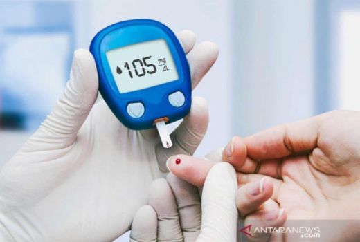 3 Manfaat Air Rebusan Daun Salam, Selamat Tinggal Diabetes - GenPI.co SULSEL