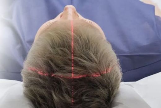 Yuk Kenalan Sama 8 Jenis Tumor Otak, Mulai Jinak Sampai Galak - GenPI.co SULTRA