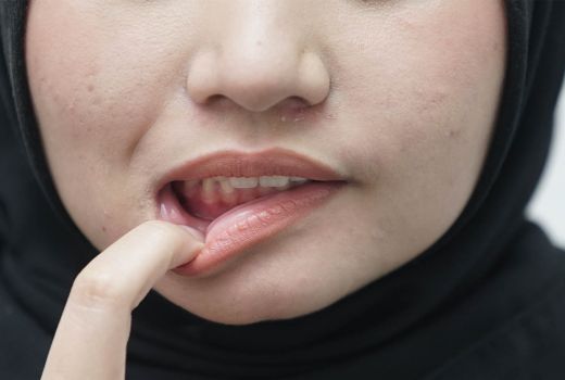 Jangan Abaikan, 10 Efek Samping Ciuman Bibir Bisa Berakibat Fatal - GenPI.co SULTRA
