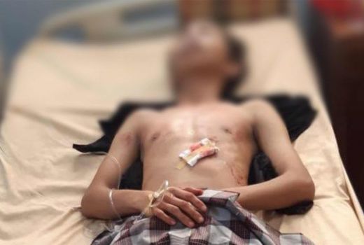 Geger, Pemuda di Kendari Ditikam, Nyawa Nyaris Melayang - GenPI.co SULTRA