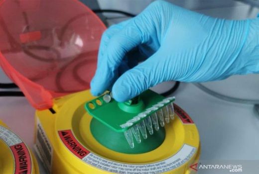 Geger 2 Anak Meninggal di Sultra, Darah dan Obat Dikirim ke Kemenkes - GenPI.co SULTRA