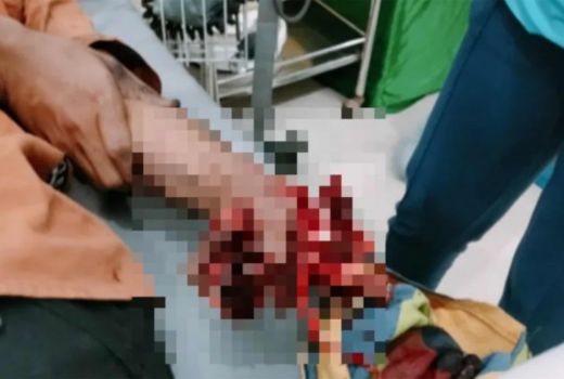 Duar! Tangan Sekuriti BMKG di Konawe Hancur Kena Petasan Tahun Baru 2023 - GenPI.co SULTRA