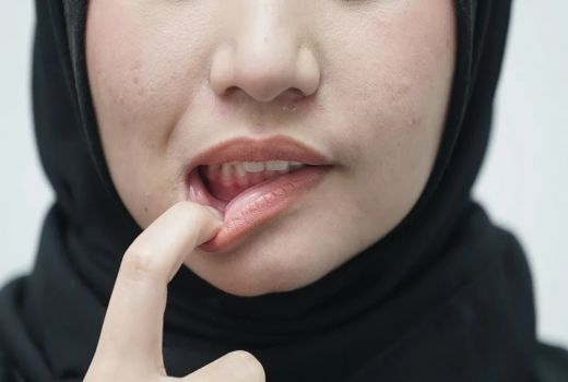 Punya Karang Gigi? Coba Hilangkan Pakai Garam, Manjur Banget - GenPI.co SUMSEL