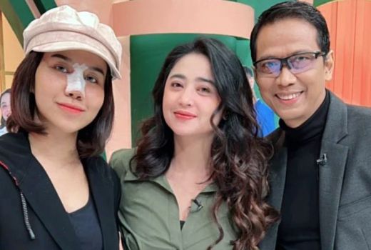 Bukan Endorse, Ternyata Sebegini Biaya Operasi Hidung Mayang - GenPI.co SUMSEL