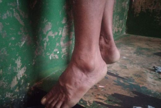 Astaga, Warga Lapas Narkotika di Langkat Gantung Diri - GenPI.co SUMUT