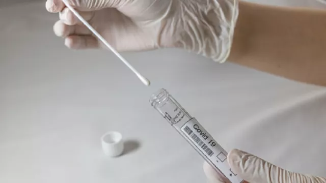 Tarif PCR di Kimia Farma Resmi Turun Jadi Rp 495 Ribu - GenPI.co