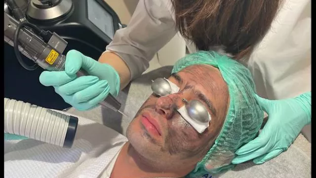 Intip Canggihnya Hollywood Spectra Peel Laser, Treatment Anti Aging Para Bintang Top - GenPI.co Intip Canggihnya Hollywood Spectra Peel Laser, Treatment Anti Aging Para Bintang Top - GenPI.co