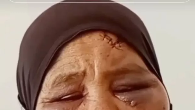Tolak Tambang di Pasaman, Nenek Saudah Dianiaya hingga Wajah Lebam dan Mata Membiru - GenPI.co