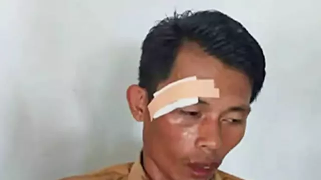 Ngeri! Tegur Murid Bolos, Guru SMP di Luwu Utara Dianiaya, Alis Robek Mata Memar - GenPI.co