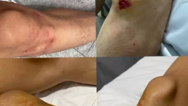 Viral! Tegur Tetangga Main Drum, Pria di Jakarta Barat Dianiaya, Saling Lapor Polisi - GenPI.co