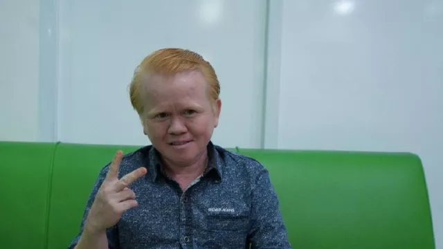 Kisah Trio Albino dan Tantangannya Menghadapi Dunia Keaktoran - GenPI.co