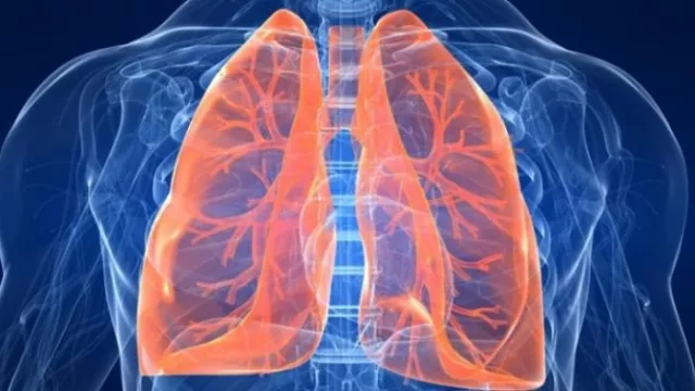 Selain Setop Merokok, Lawan Kanker Paru-paru dengan Cara Berikut - GenPI.co