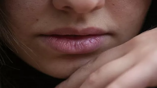 Selain Merokok, 4 Penyebab Bibir Menghitam - GenPI.co
