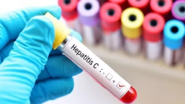 5 Aktivitas Ini Tidak Membantu Menyembuhkan Penyakit Hepatitis - GenPI.co
