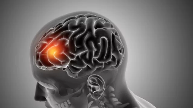 Pakar Peneliti Temukan Perubahan Otak Manusia Karena Covid-19 - GenPI.co