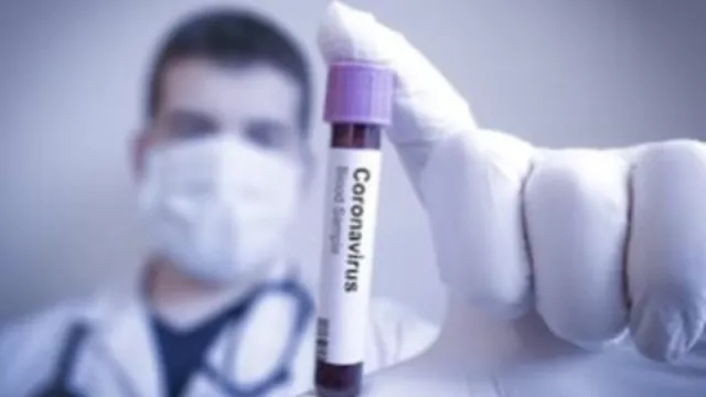 Catat! 4 Fakta Virus Corona Biar Nggak Gagal Paham - GenPI.co Catat! 4 Fakta Virus Corona Biar Nggak Gagal Paham - GenPI.co