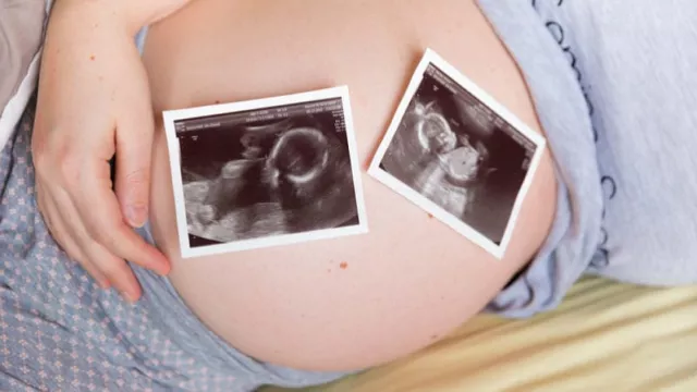 Hamil Anak Kembar Pasti Bikin Happy, Pahami 4 Cirinya Ini - GenPI.co